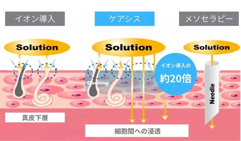 その他の浸透治療との比較